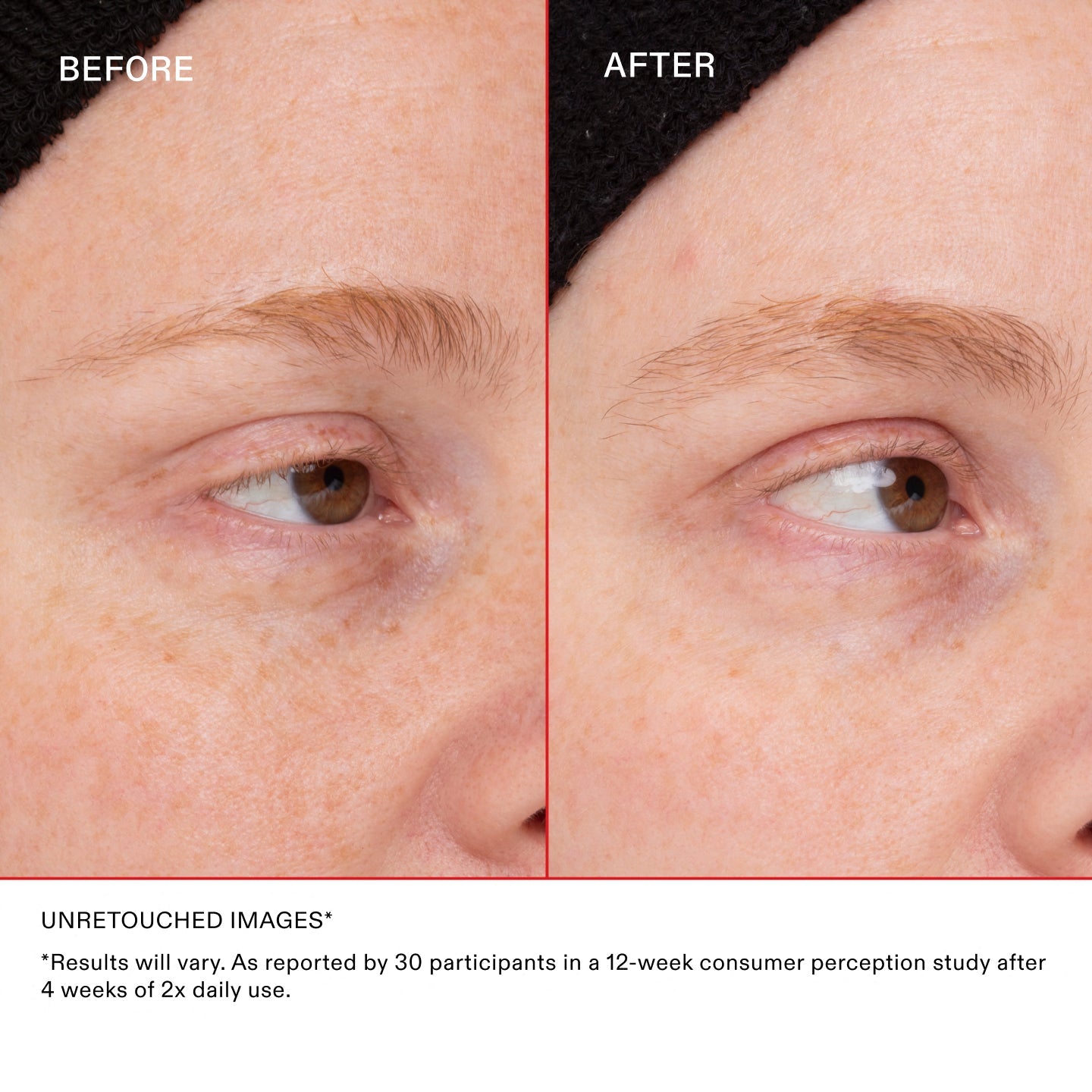 *Results will vary. As reported by 30 participants in a 12-week consumer perception study after 4 weeks of 2x daily use. 