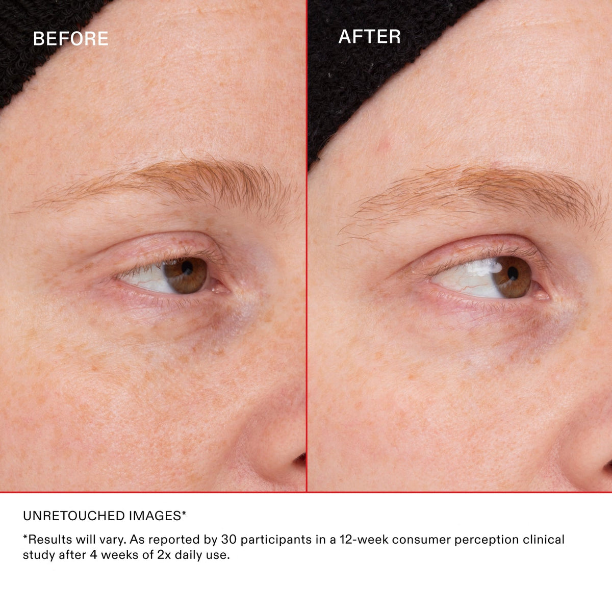 *Results will vary. As reported by 30 participants in a 12-week consumer perception clinical study after 4 weeks of 2x daily use.