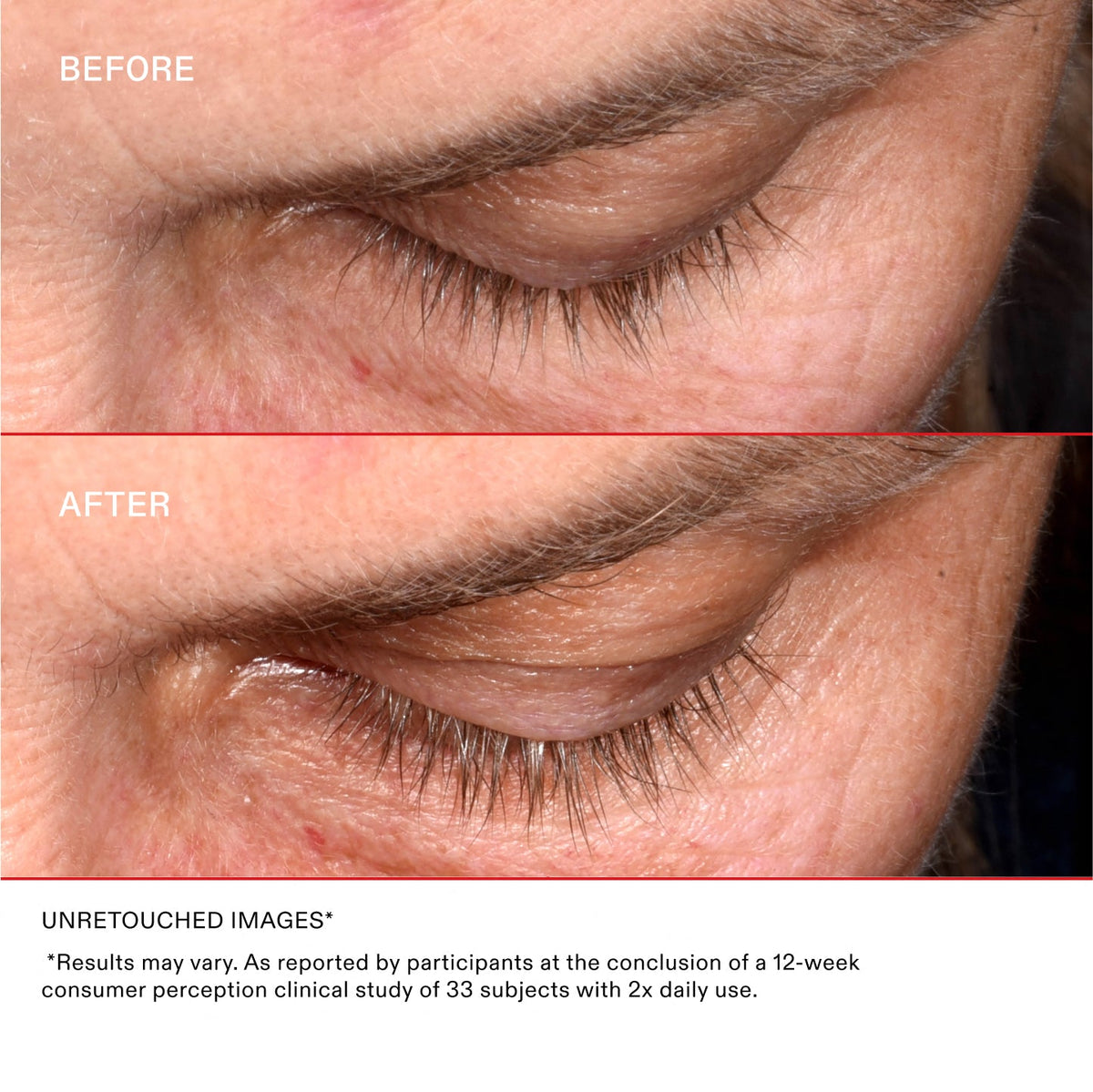 UNRETOUCHED IMAGES*

 *Results may vary. As reported by participants at the conclusion of a 12-week consumer perception clinical study of 33 subjects with 2x daily use.